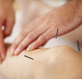 &copy; Victory Megannety - Patient getting treatment on Acupuncture  -March 2012